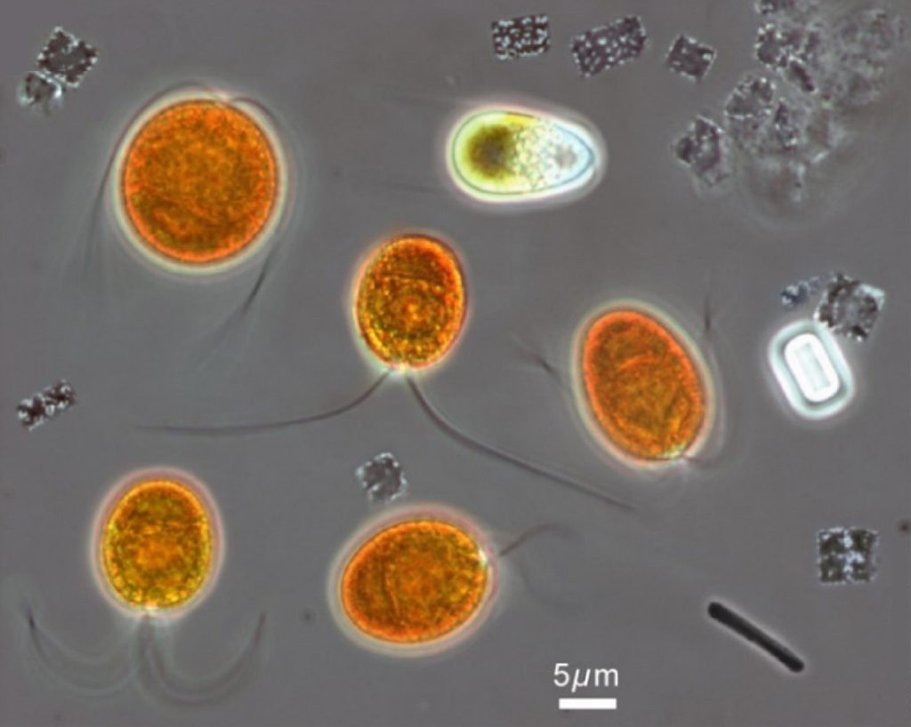 Dunaliella salina cells under the microscope